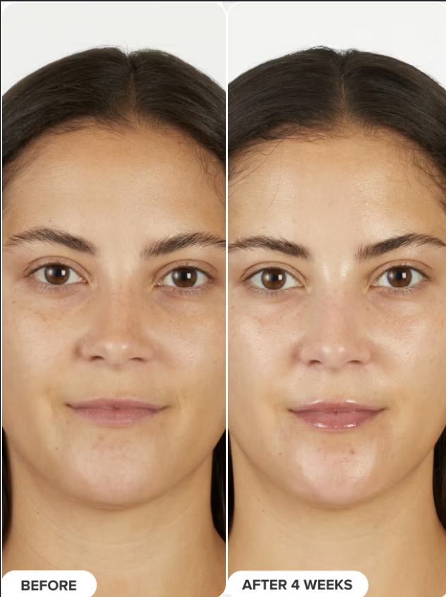 Transformación 4